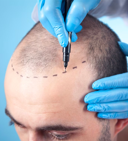 centerhairmedical-clinica-istanbul-4