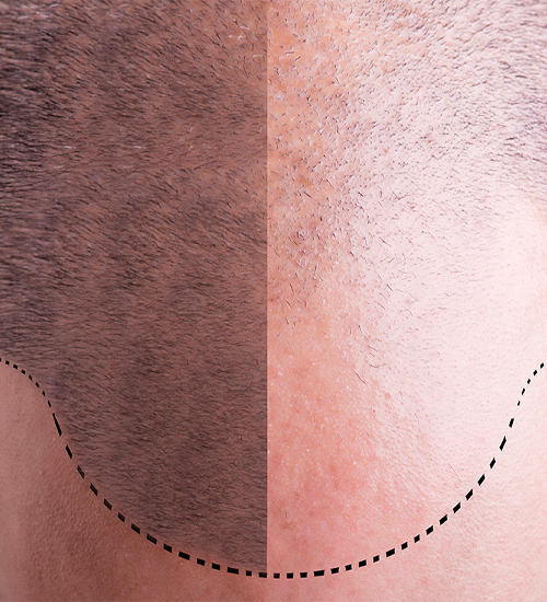 centerhairmedical-clinica-istanbul-5